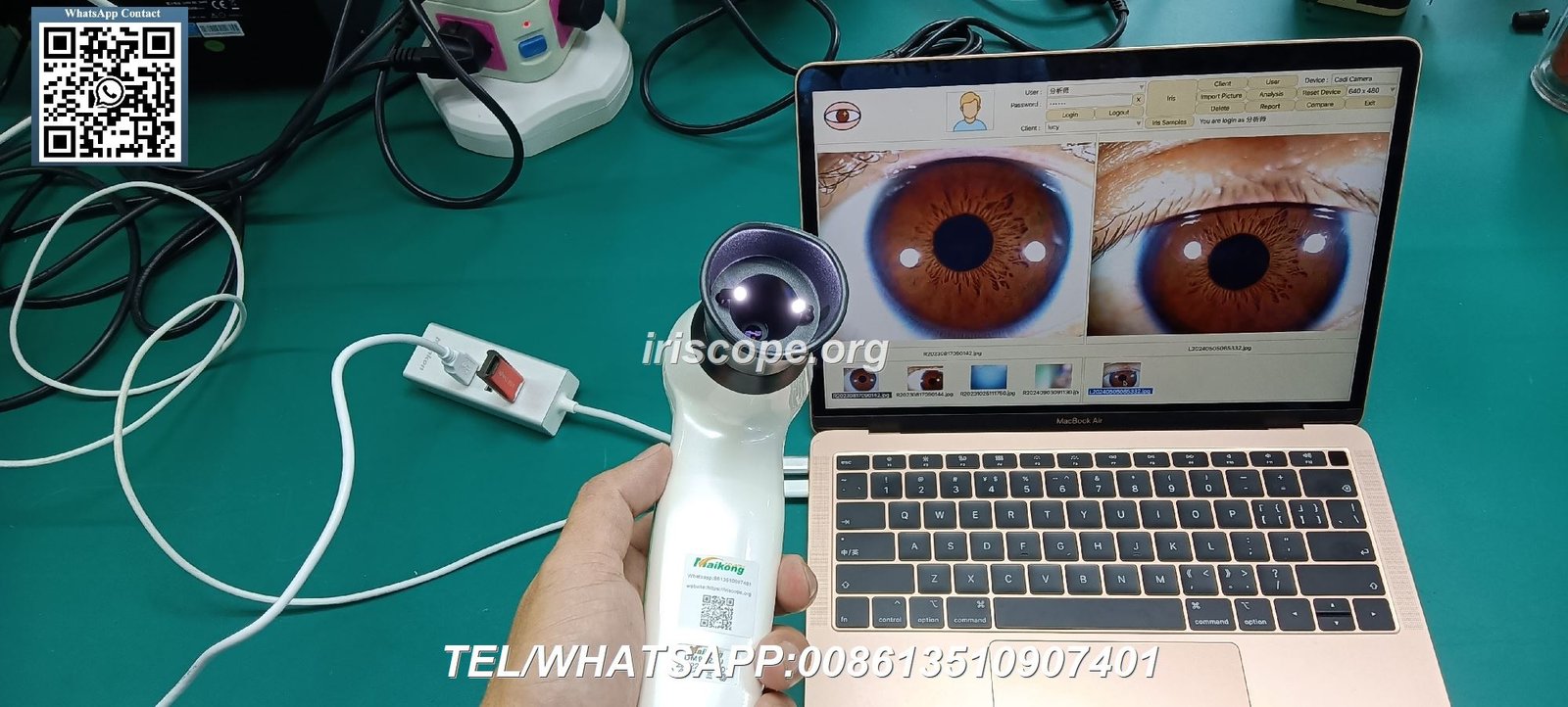 appareil photo pour iridologie