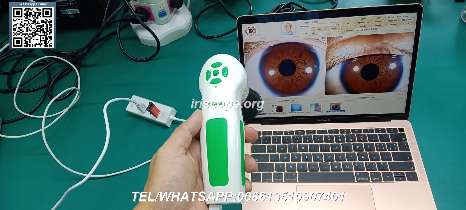 appareil photo pour iridologie