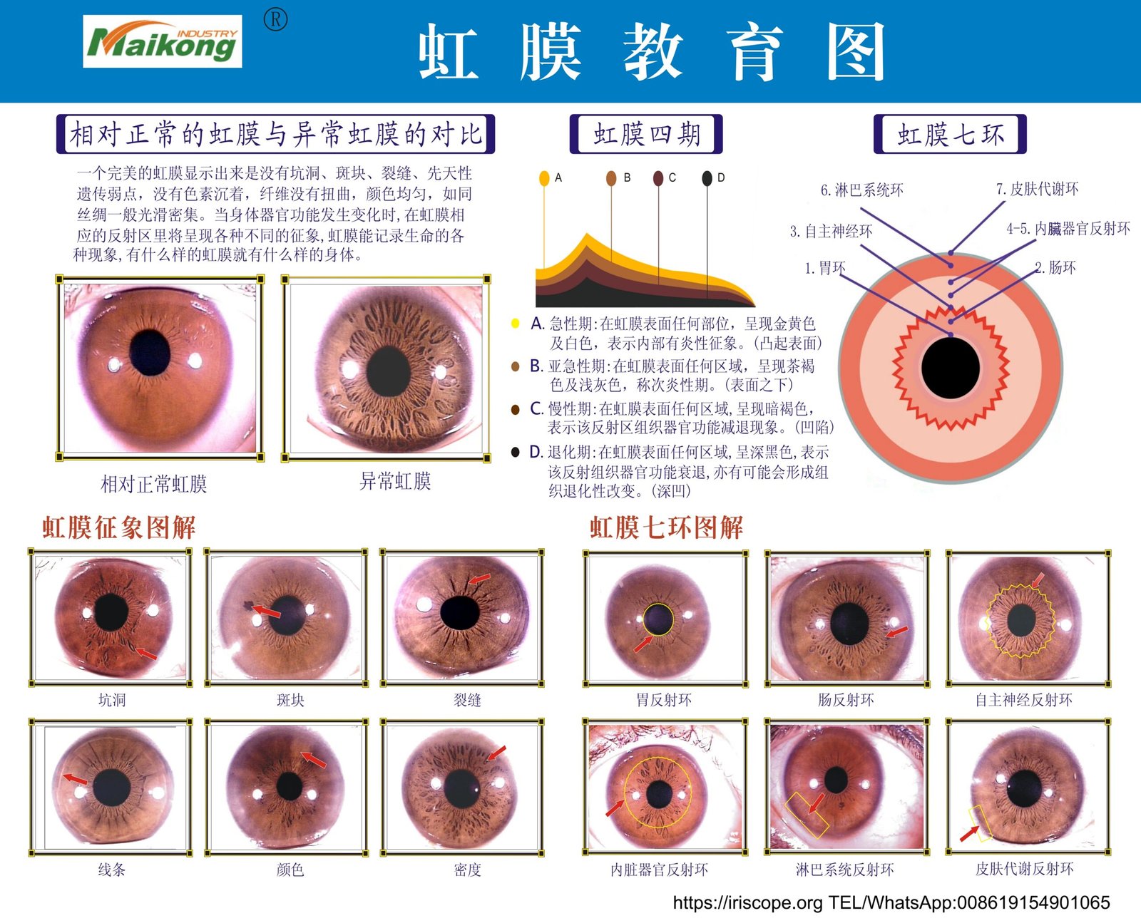 Fonctionnement complet d'un appareil photo iridologie pour débutants 20 MAIKONG carte iridologie (23)