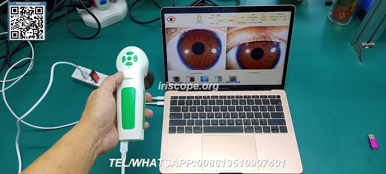 Appareil Iridologie Cdiscount