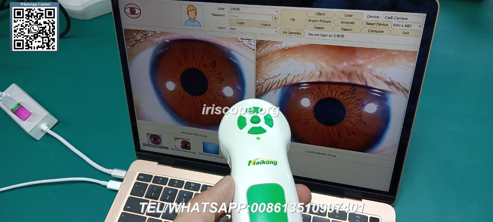 Acheter Appareil Iridologie en Français: Guide Complet par MAIKONG 4 Acheter Appareil Iridologie en Français