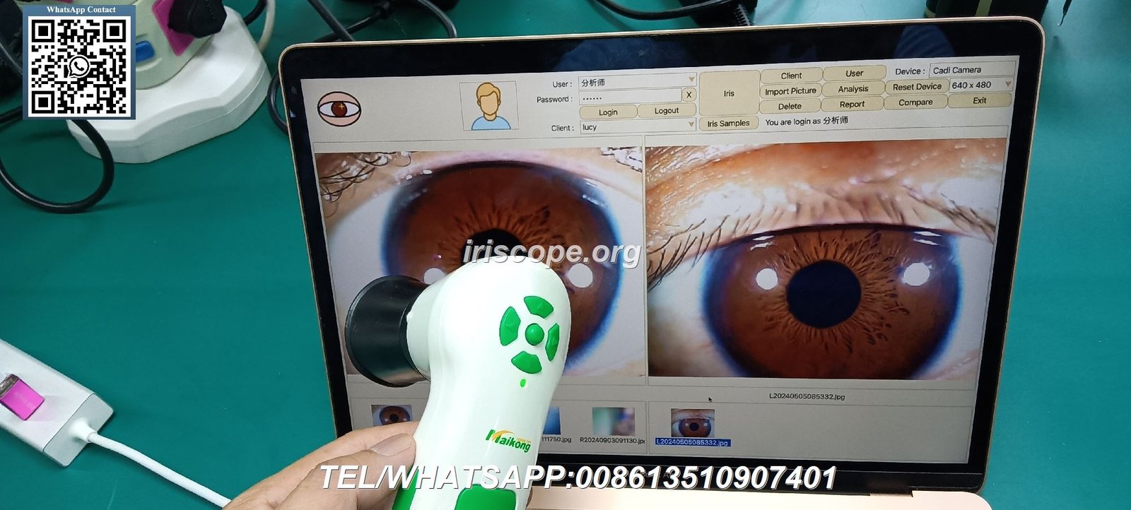 Iridologie : Comprendre la Pratique, la Terminologie et les Applications Professionnelles 9 appareil photo pour iridologie
