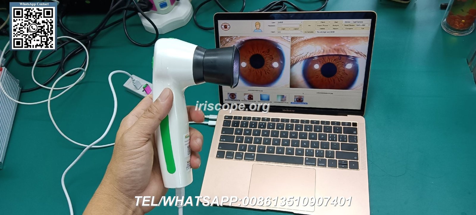 Matériel pour Examen Iridologie Professionnel - France MAIKONG 1 Matériel pour Examen Iridologie
