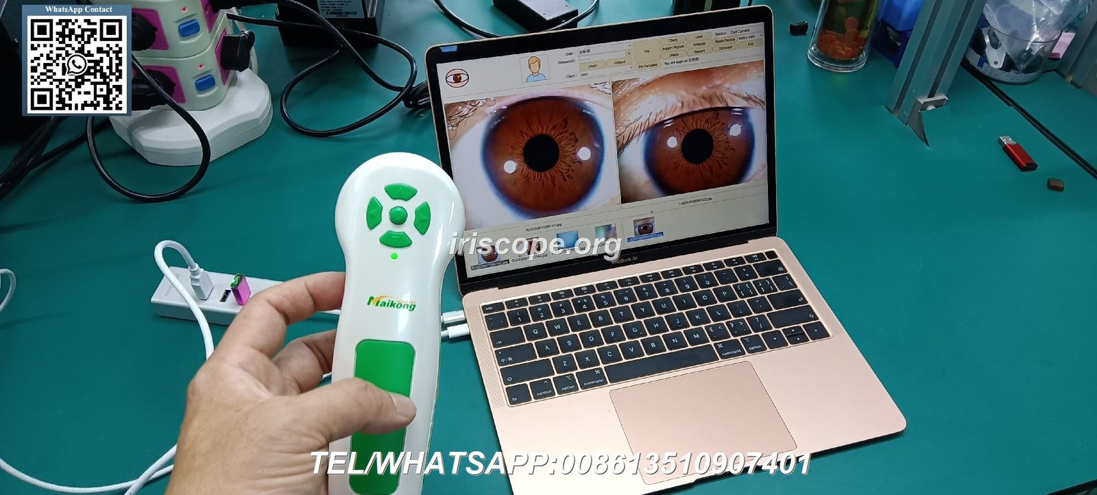 Appareil professionnel pour iridologie AIKONG montrant les détails de l'iris