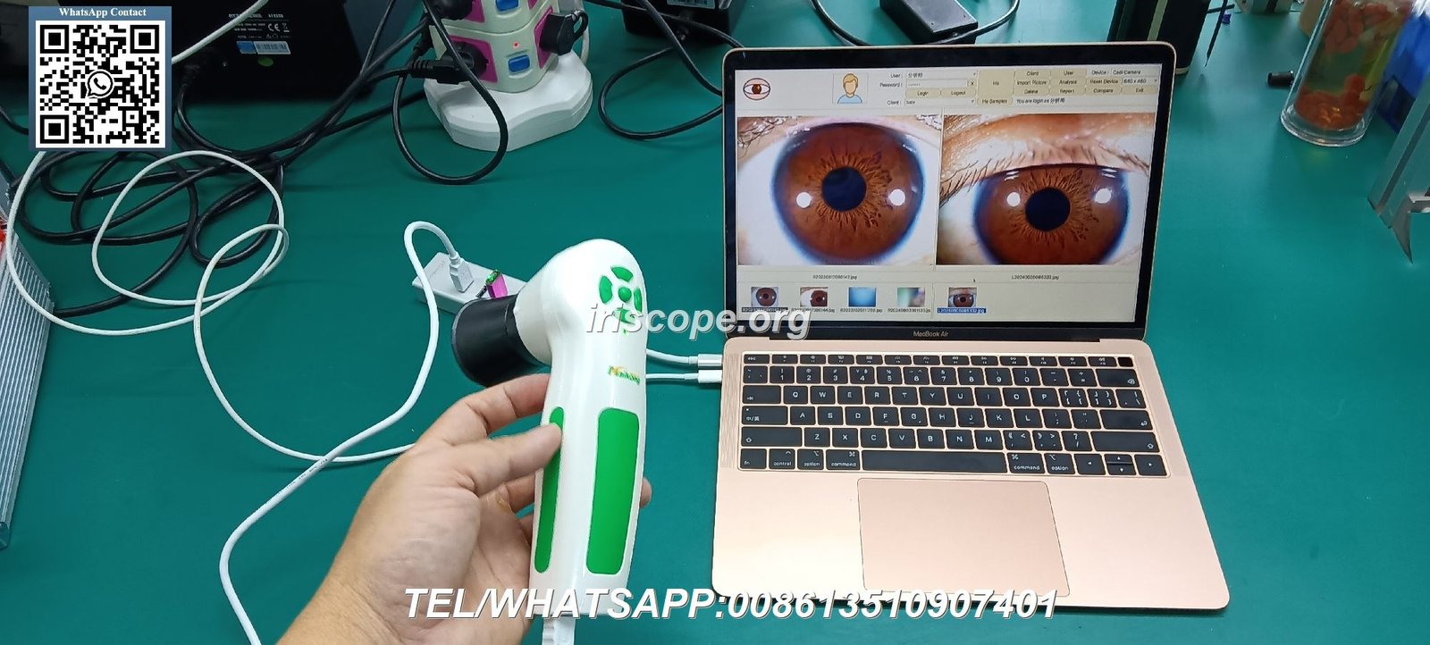 Appareil Iridologie Cdiscount