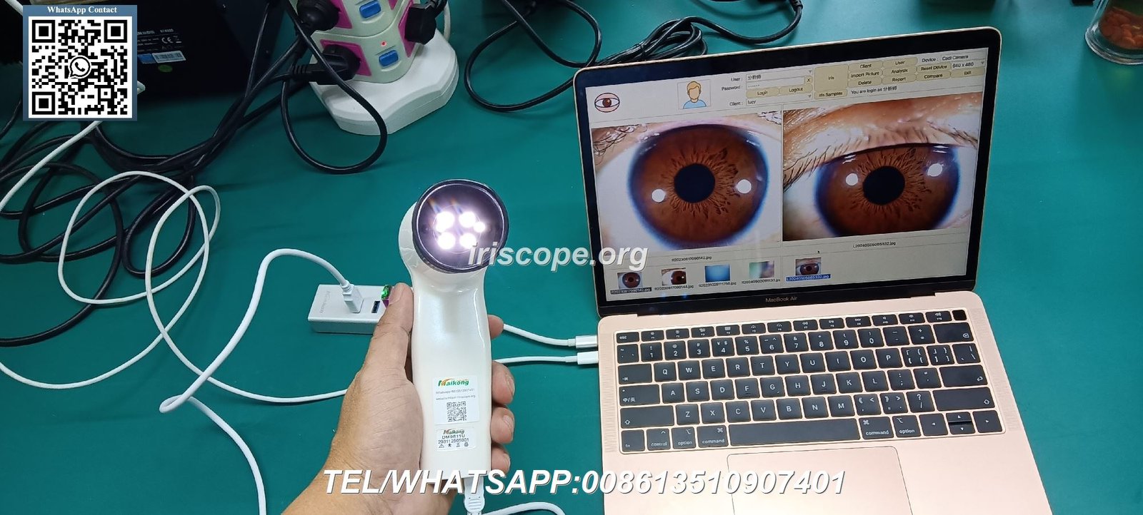 Prix Appareil Iridologie