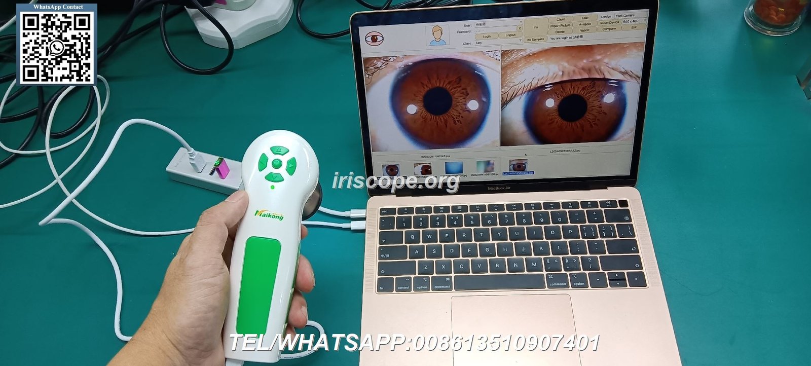 Appareil Iridologie sous Windows 10