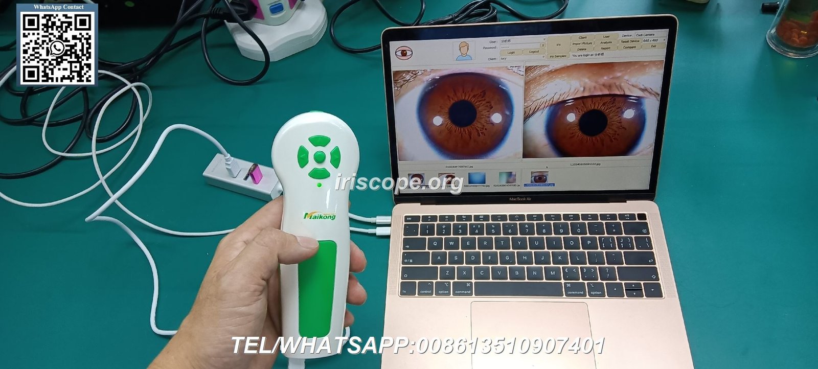 Prix Appareil Iridologie