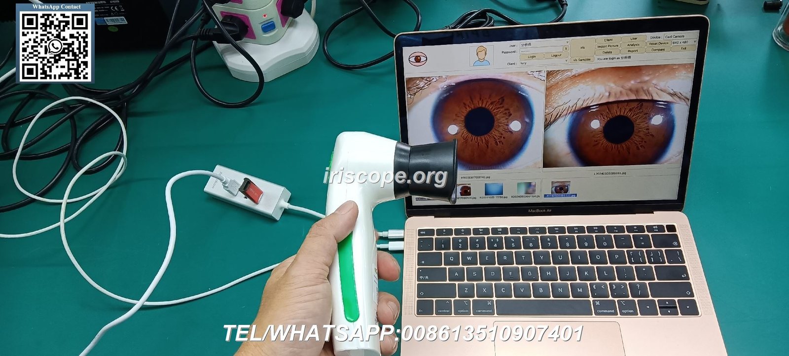 appareil photo iridologie