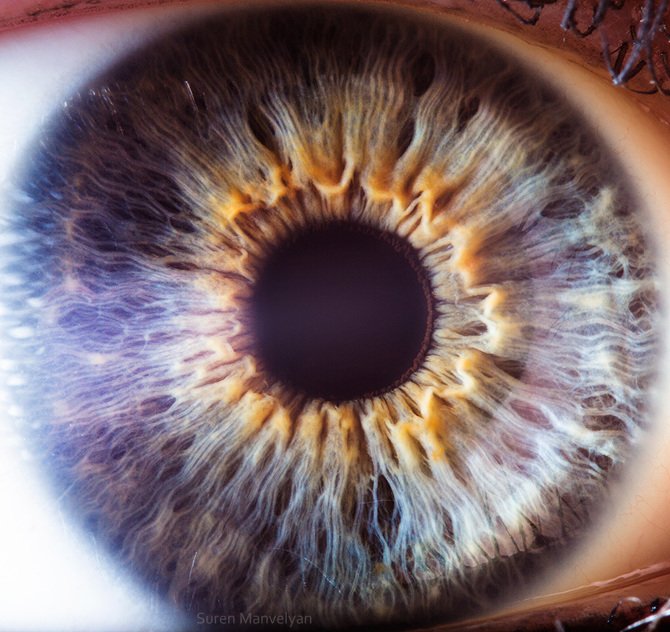 Appareil photo pour iris: guide pratique pour revendeurs en France — Iridología (12).JPG