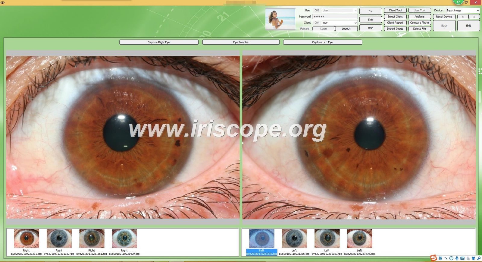 Logiciel d’iridologie: guide pratique pour les revendeurs de technologies de santé en France — Software de Iridología (29).JPG