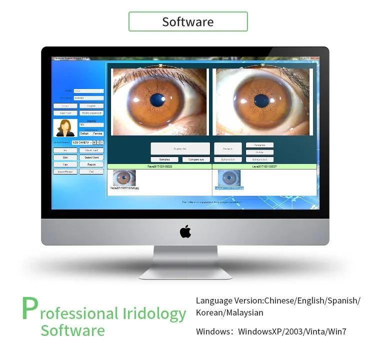 MAIKONG WIFI 20MP Iriscope camera MK 9888U — appareil photo iridologie (18).jpg