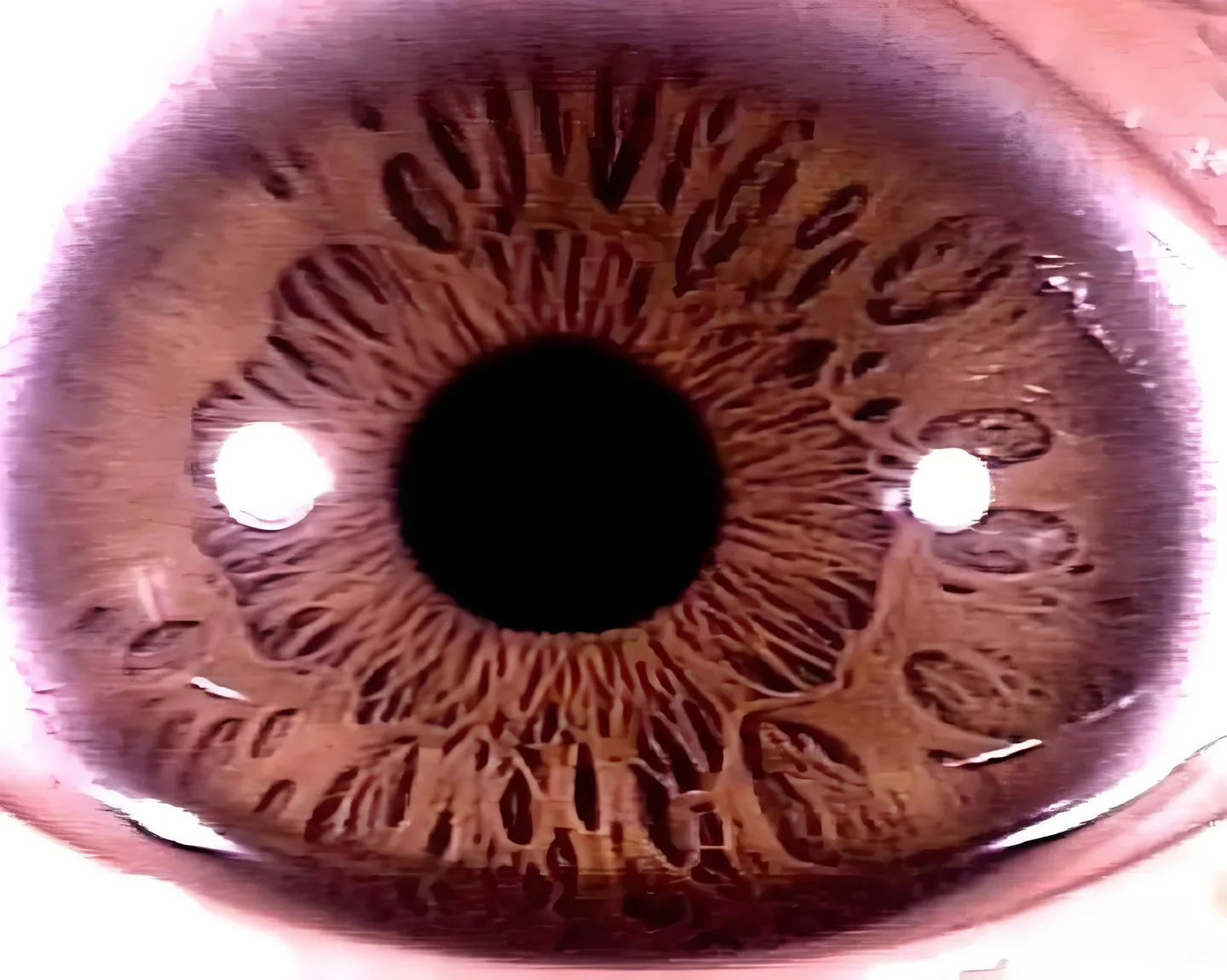 Iridoscope pour naturopathe: quel appareil choisir et comment l’intégrer à votre pratique en France — Iridology Between Pit iris.jpg