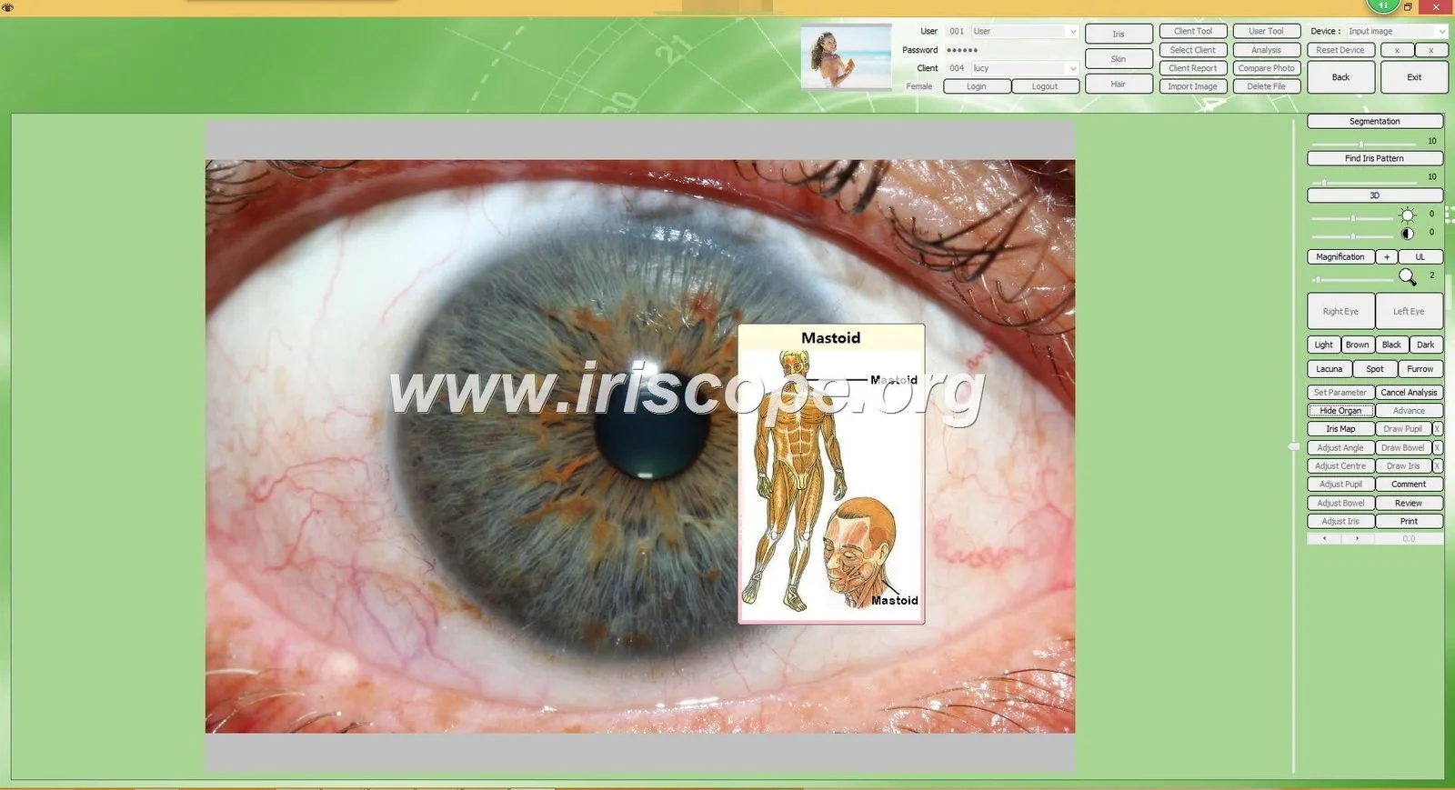 IrisExplorer v5.1: guide opérationnel pour grossistes et fournisseurs professionnels en France 16 IrisExplorer v5.1: guide opérationnel pour grossistes et fournisseurs professionnels en France — Software de Iridología (37).JPG