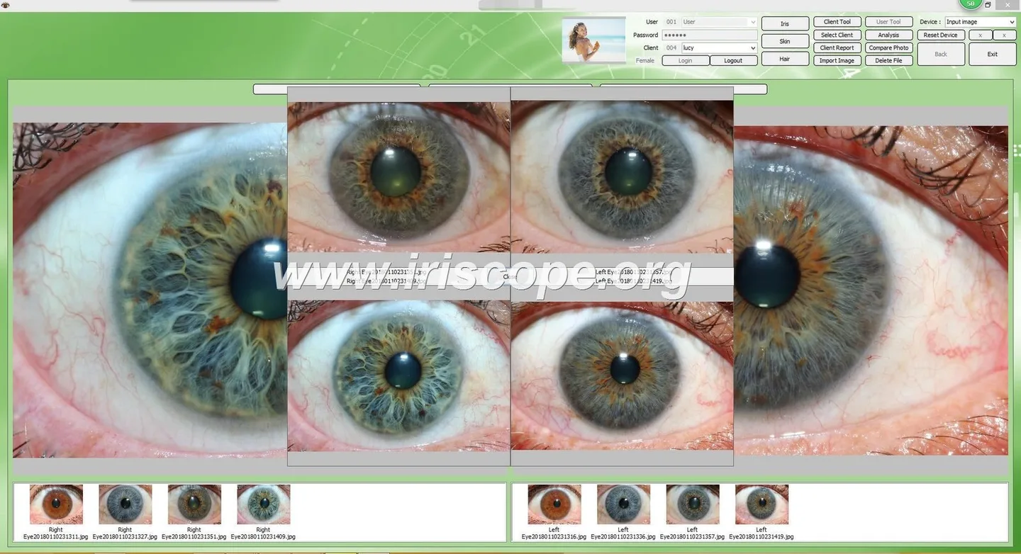 Iriscope iridology camera MK-12 6 Iriscope iridology camera MK-12 — MAIKONG IRIDOLOGY CAMERA (549).JPG