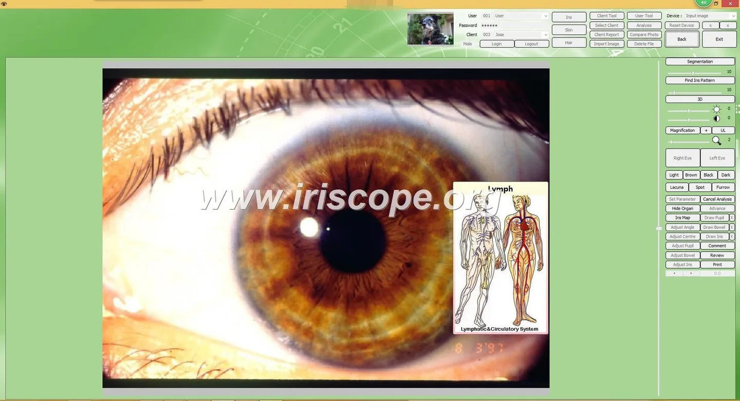 Loupe iridologie: guide pratique pour revendeurs d’équipement de santé en France — MAIKONG IRIDOLOGY CAMERA (548).JPG