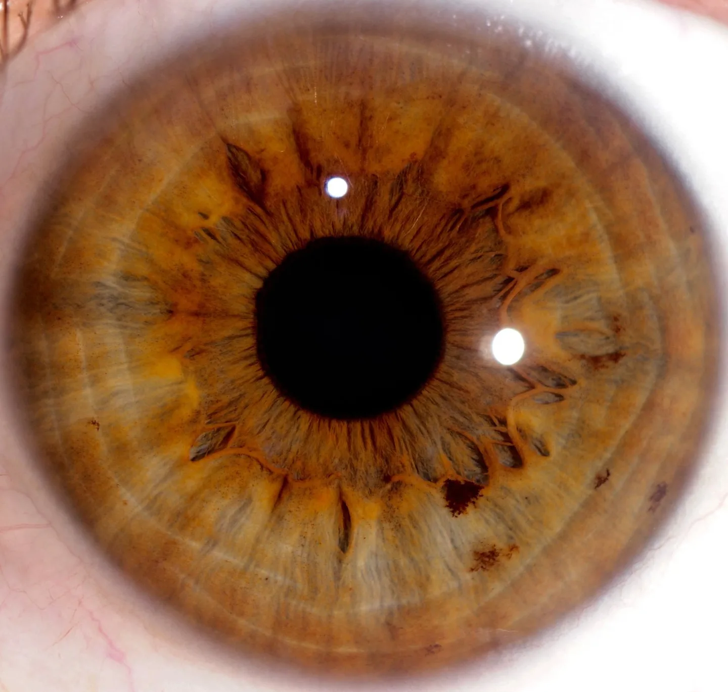 Advanced Iriscope Skills — session 1‑à‑1 pour revendeurs en France — Iridología (4).jpg