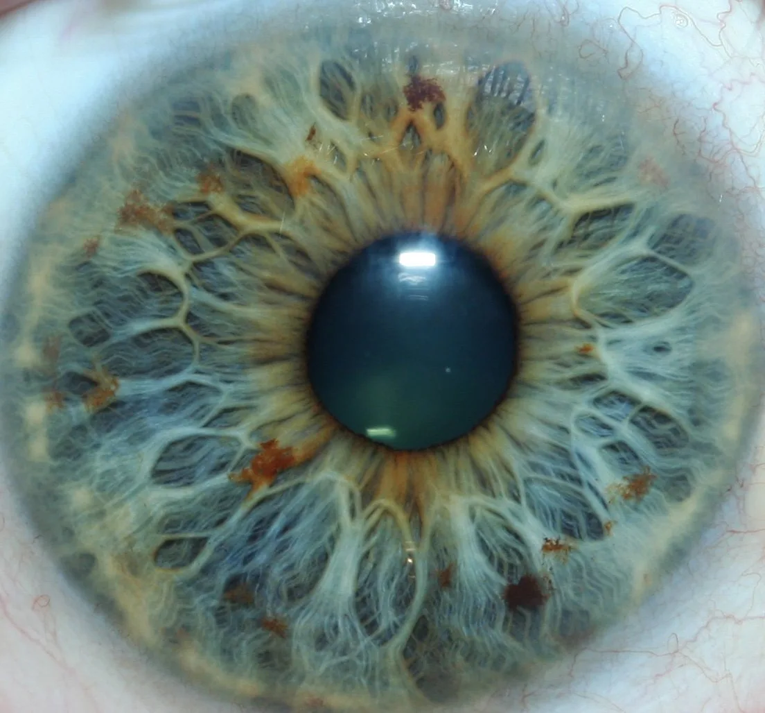 Ce que doivent savoir les grossistes en France avant de référencer un iridologue — httpsiriscope.orgwp-contentuploads202507Person-researching-iridology-information-on-computer-with-question-marks-overlay-1024x585.jpeg