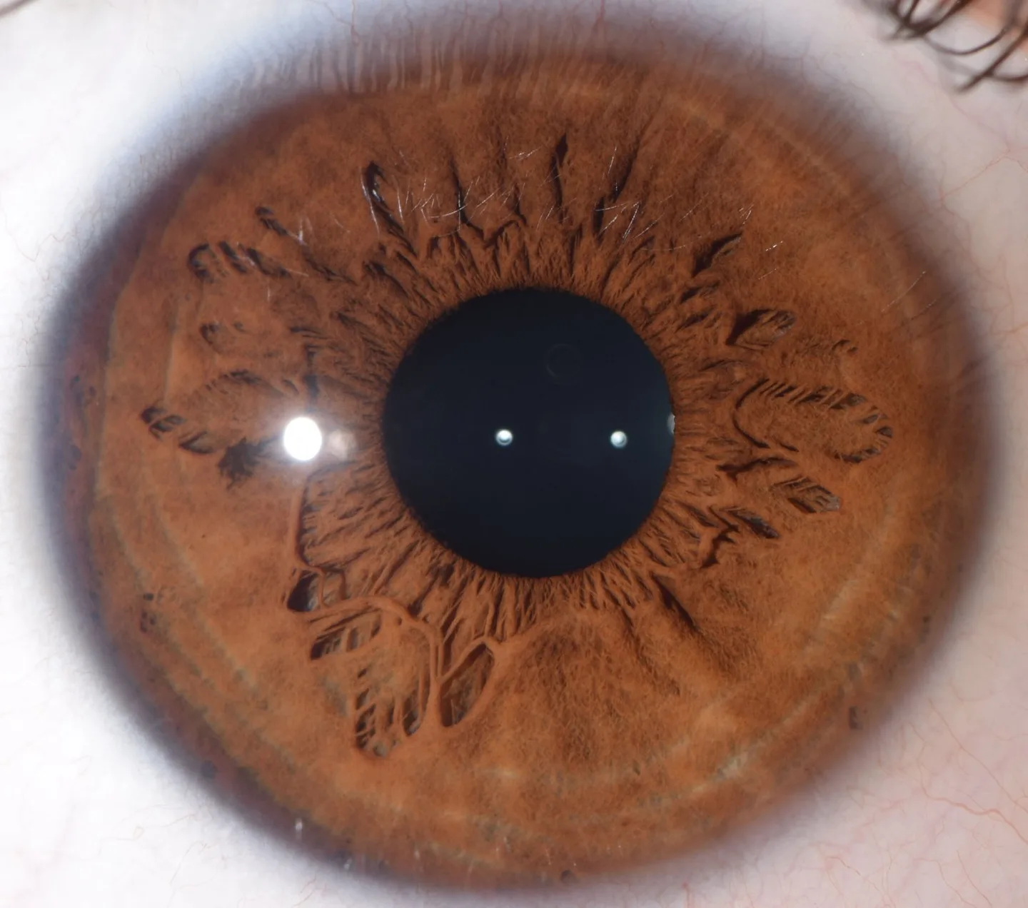 Advanced Iriscope Skills — session 1‑à‑1 pour revendeurs en France — Iridología (1).jpg